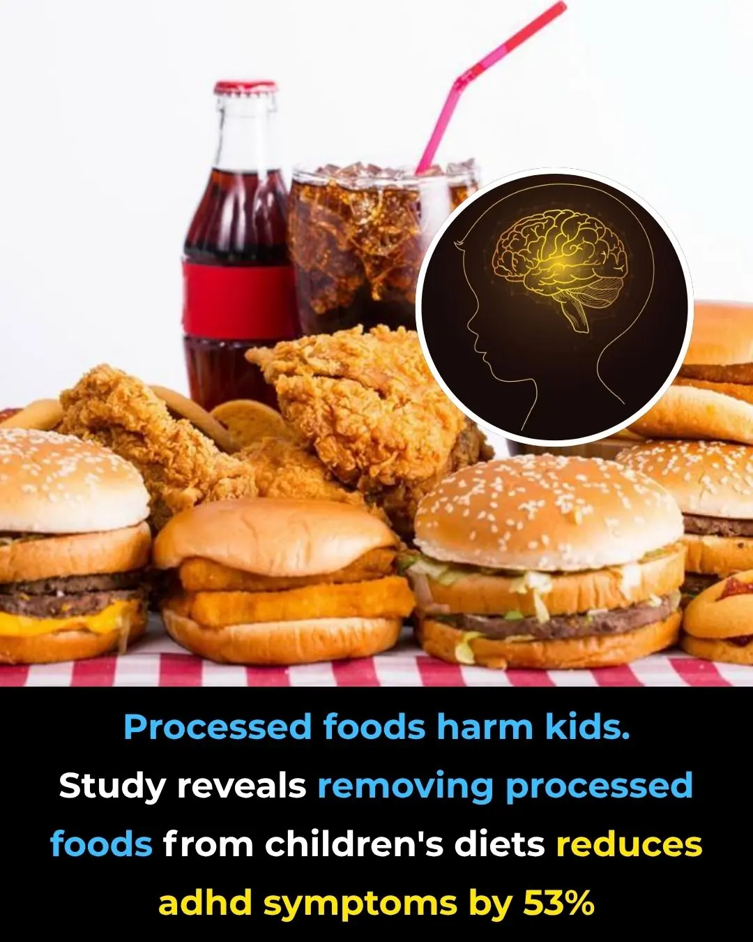 New Study Shows Removing Processed Foods Can Reduce ADHD Symptoms by 53%