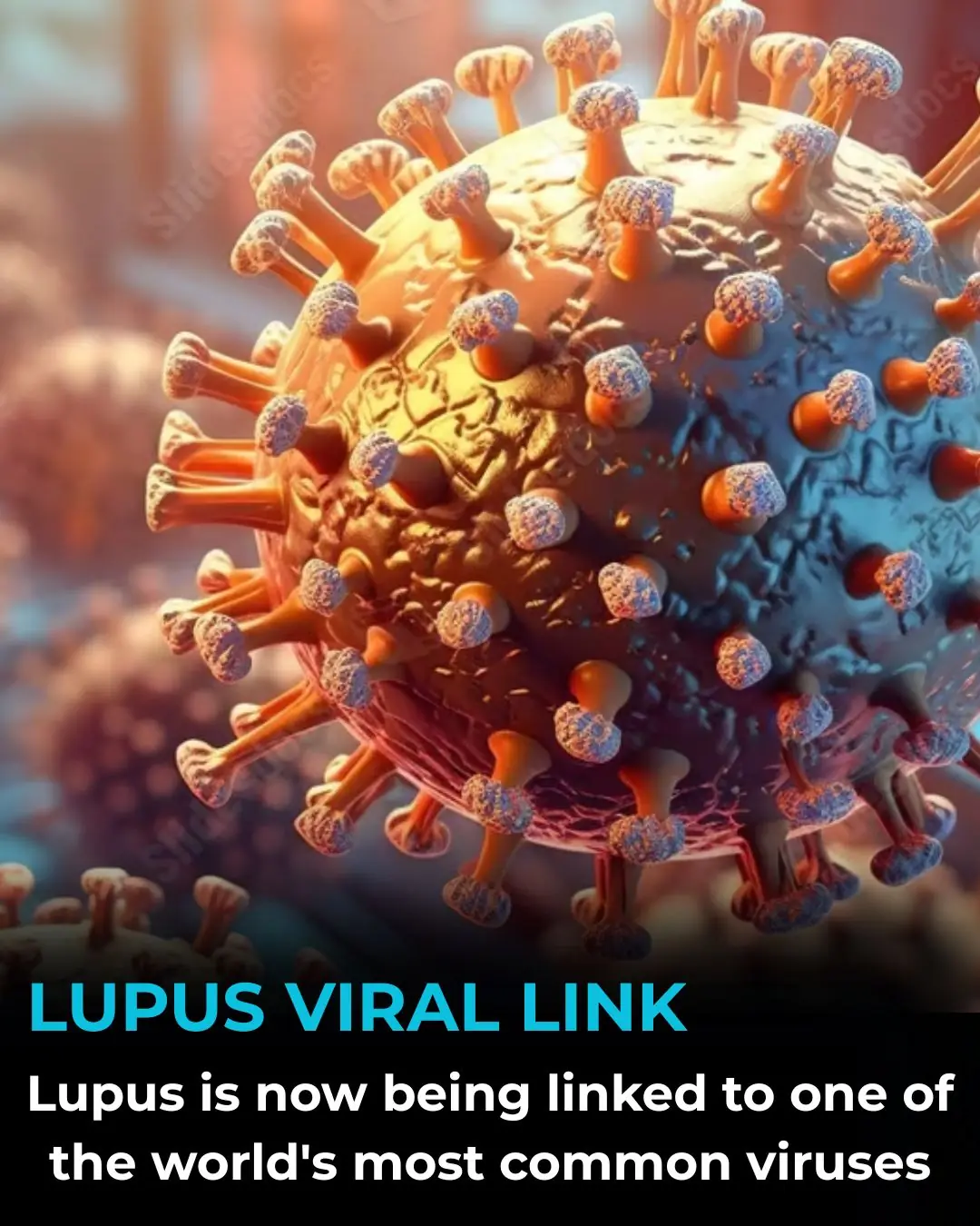 Uncovering the Viral Trigger Behind Lupus: Scientists Reveal a Surprising Link