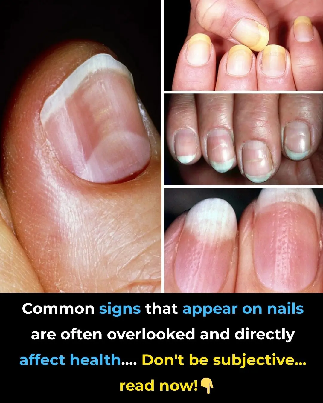 What Your Nails Reveal About Your Health: Hidden Signs You Shouldn’t Ignore