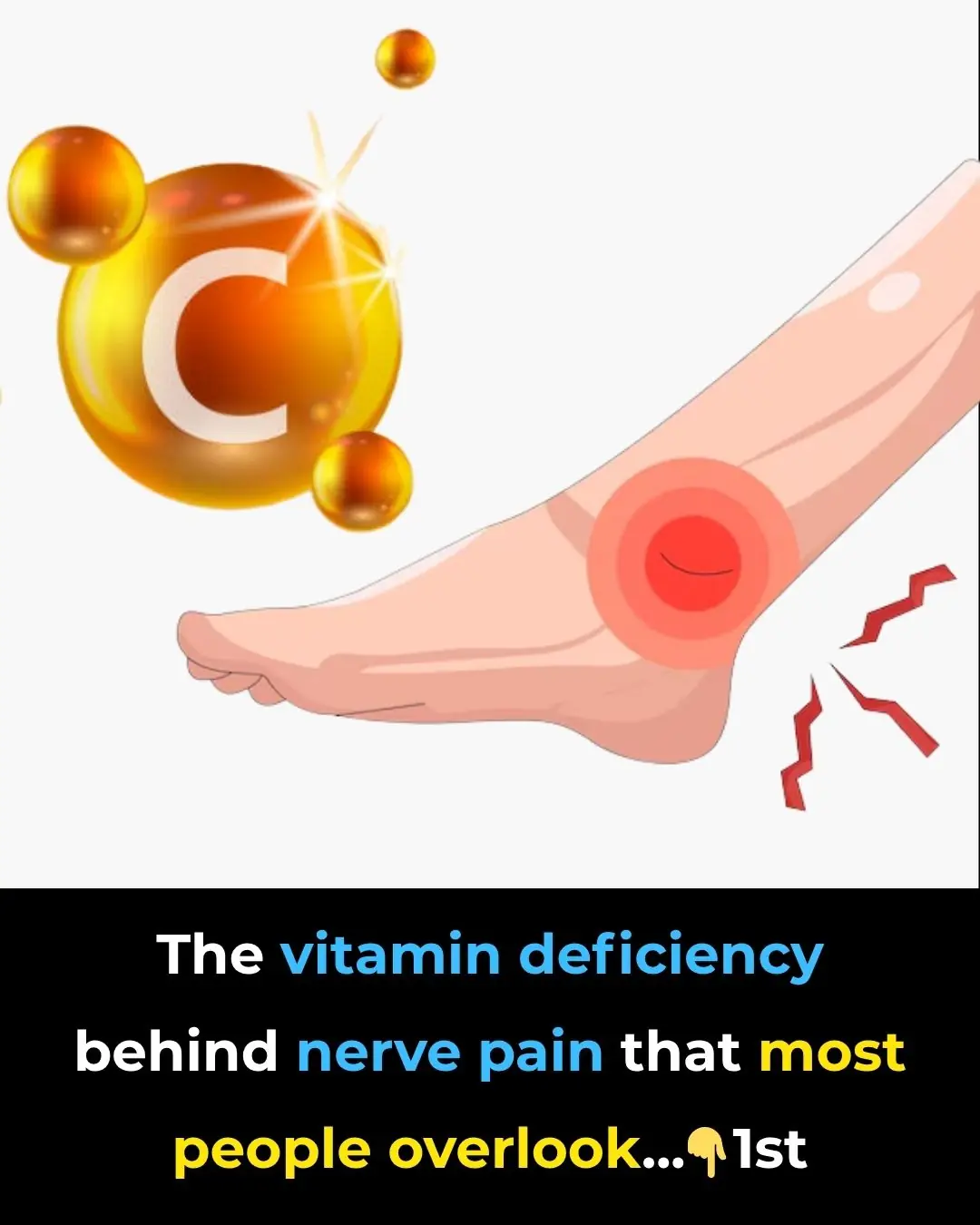 Nerve Pain Relief? The Vitamin Deficiency You Never Suspected!