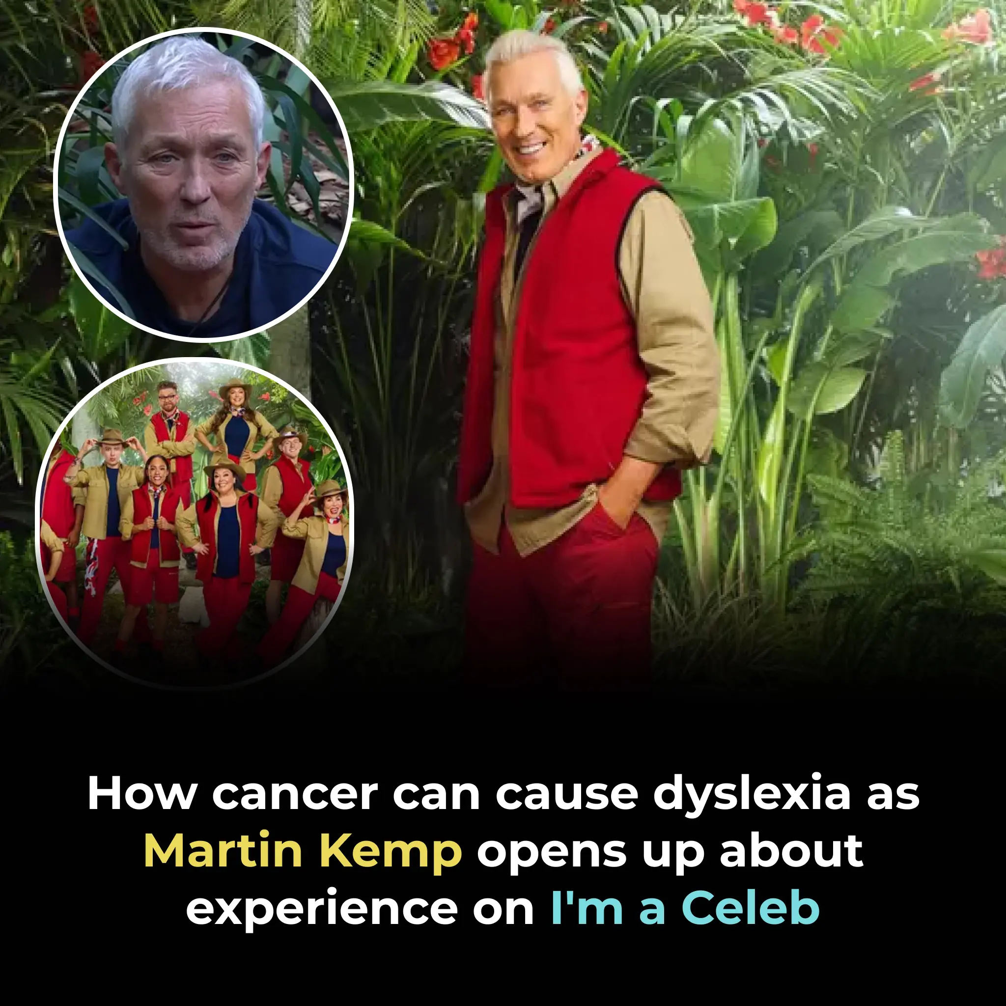 HOW CANCER CAN CAUSE DYSLEXIA AS MARTIN KEMP OPENS UP ABOUT EXPERIENCE ON I'M A CELEB