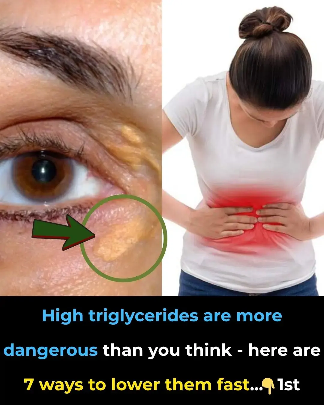 7 tips to eliminate dangerous blood fat