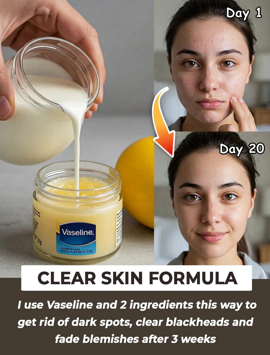 How To Use Vaseline to Get Rid of Dark Spots & Get Clear Skin