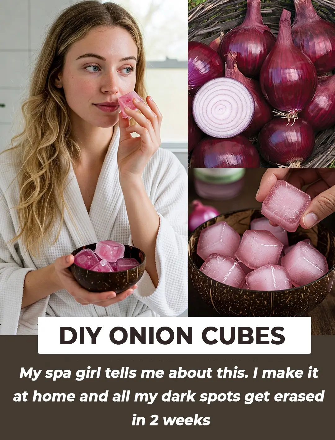 How to Get Rid of Dark Spots Using Onion Juice Ice Cubes - The Best Recipe for Even-Toned Skin