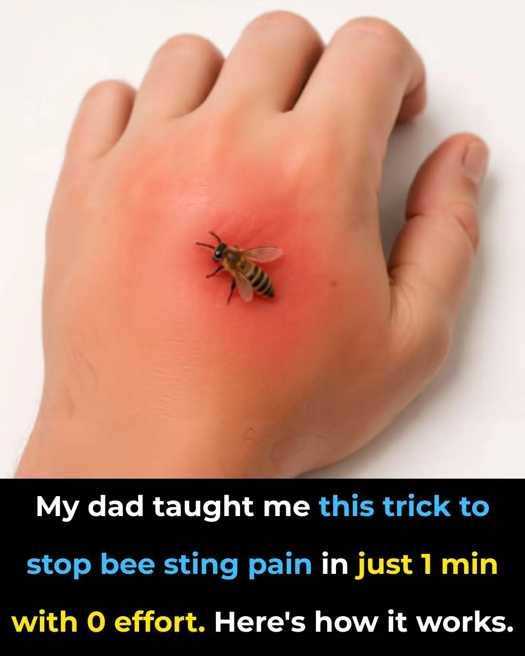 I Didn’t Know This Bee Sting Trick—My Dad Swears By It