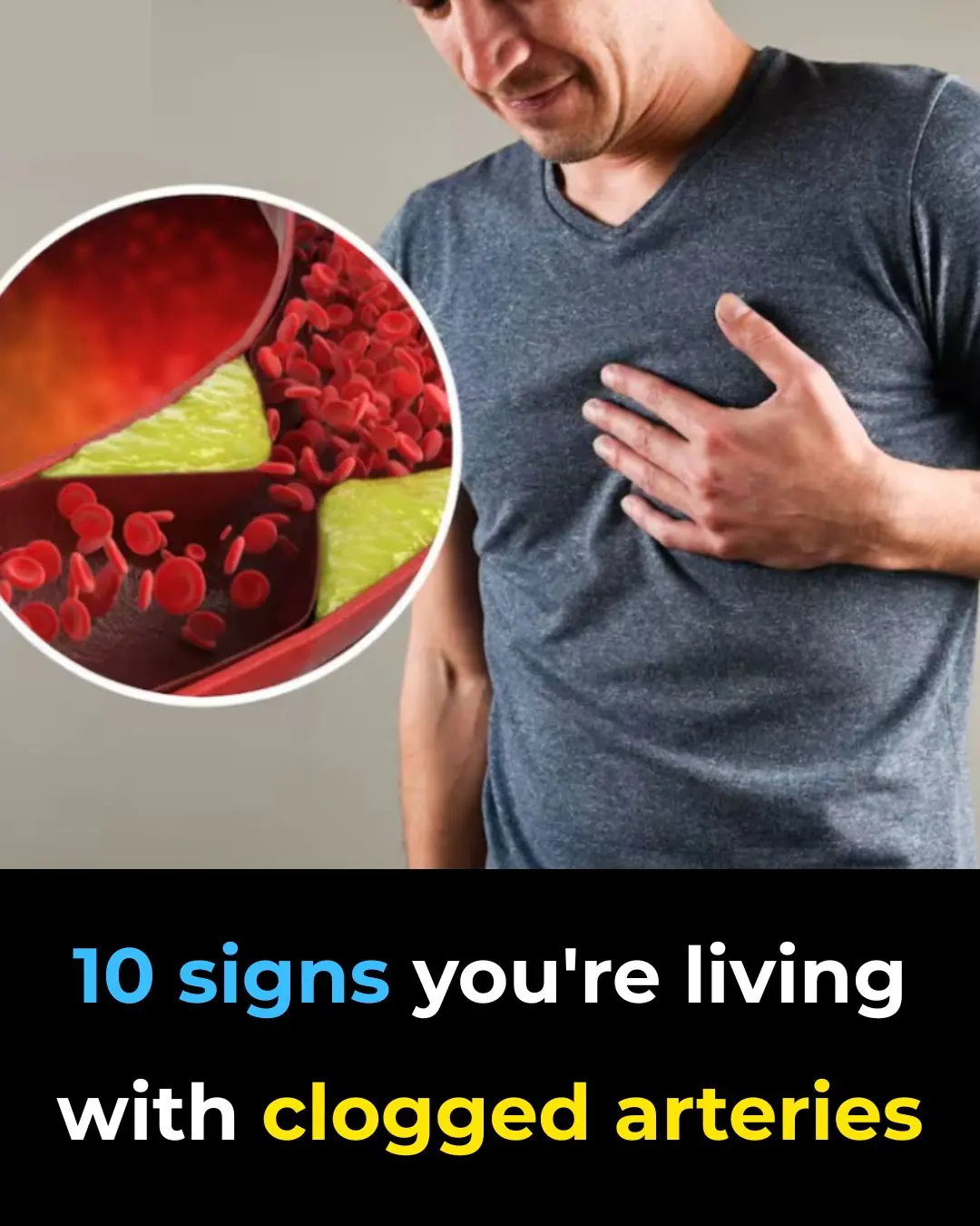 10 Subtle Symptoms of Clogged Arteries You Shouldn’t Ignore