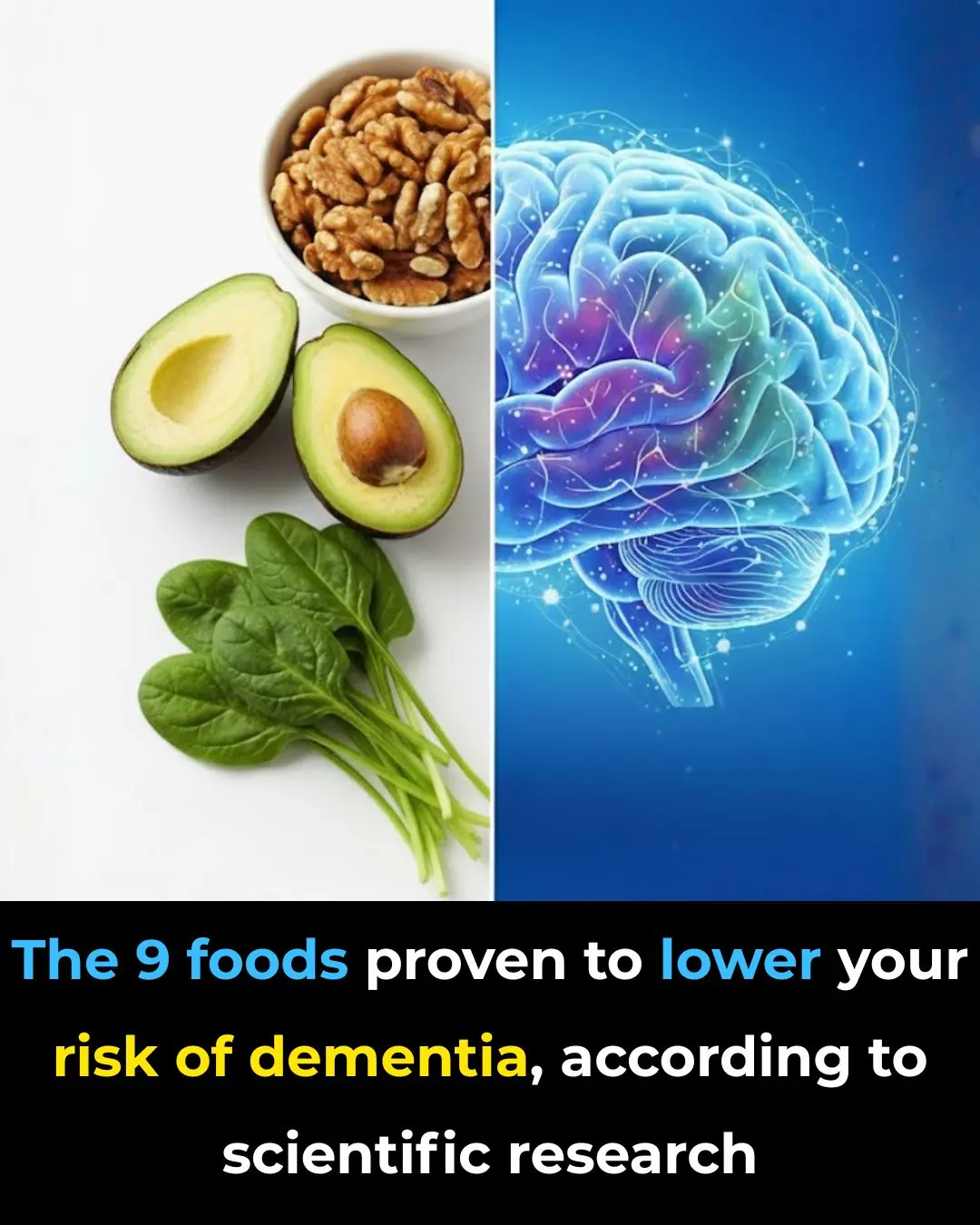 The 9 foods proven to lower your risk of dementia, according to scientific research