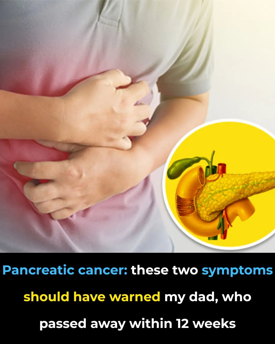 Signs of pancreatic cancer you should never ignore