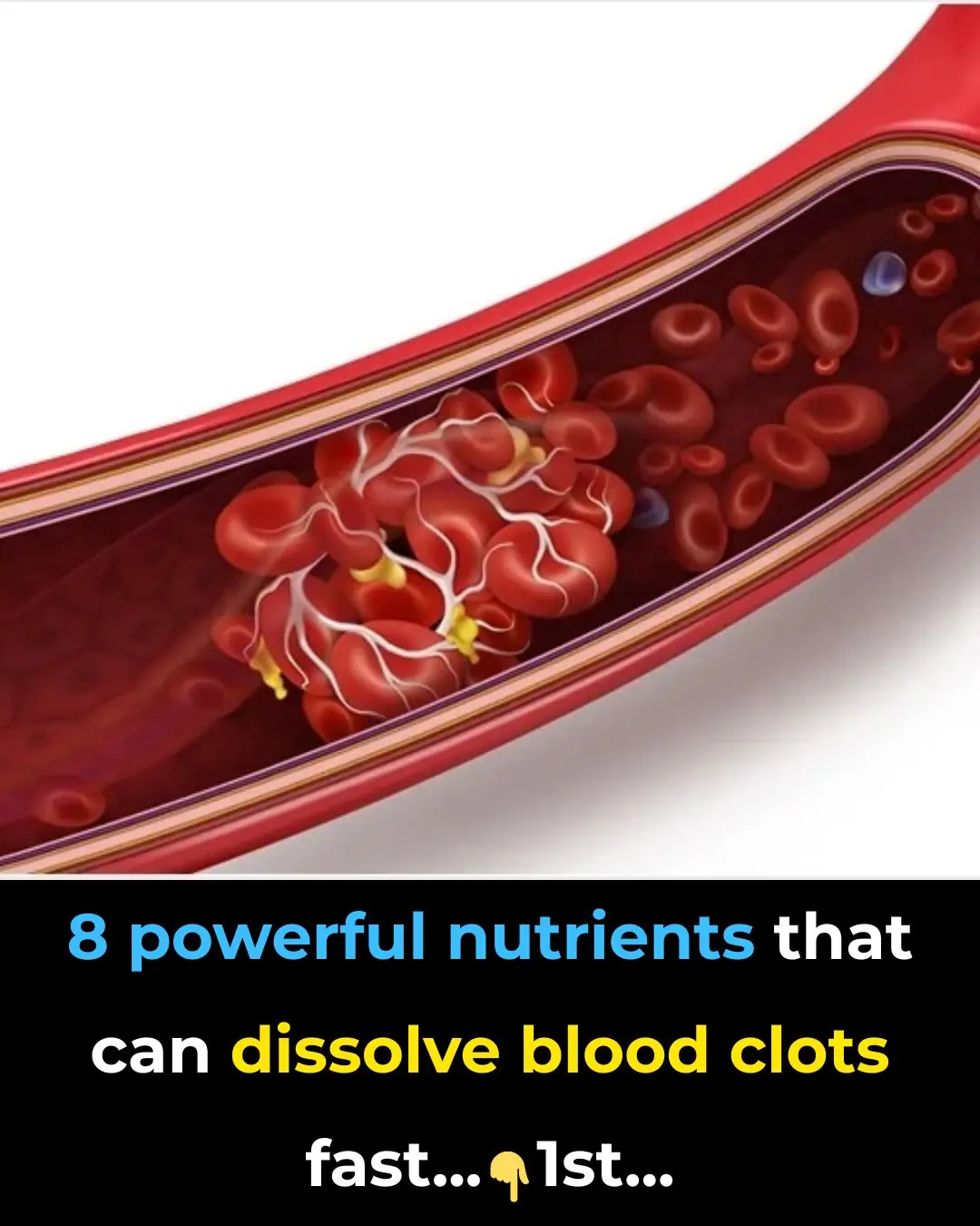 8 Powerful Nutrients That Can Dissolve Blood Clots Fast!