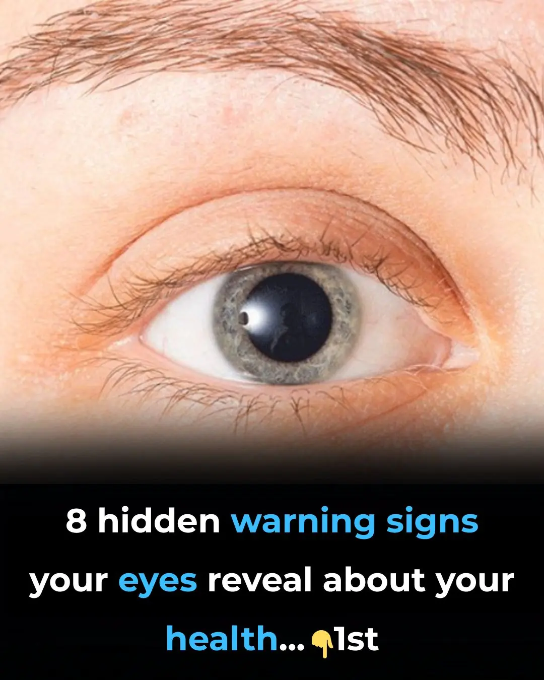 8 Things Your Eyes Are Trying To Tell You About Your Health