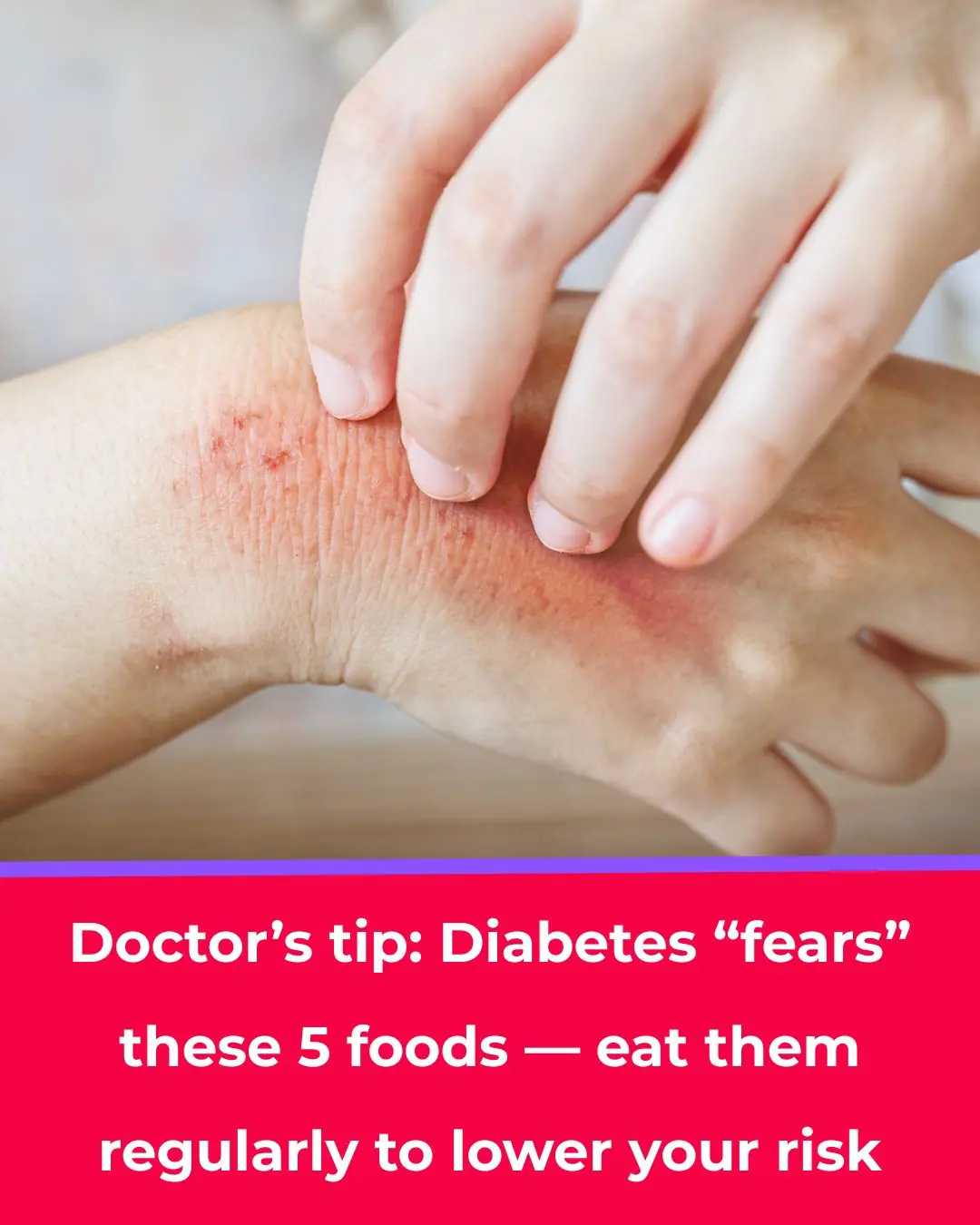 Everyone Fears Diabetes, but Diabetes “Fears” These 5 Powerful Foods