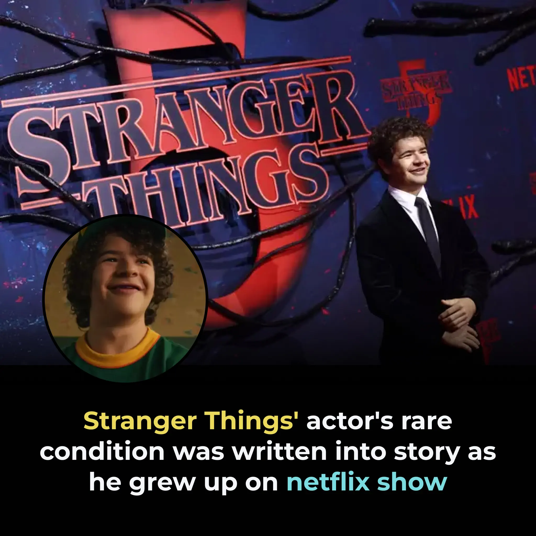 STRANGER THINGS' ACTOR'S RARE CONDITION WAS WRITTEN INTO STORY AS HE GREW UP ON NETFLIX SHOW
