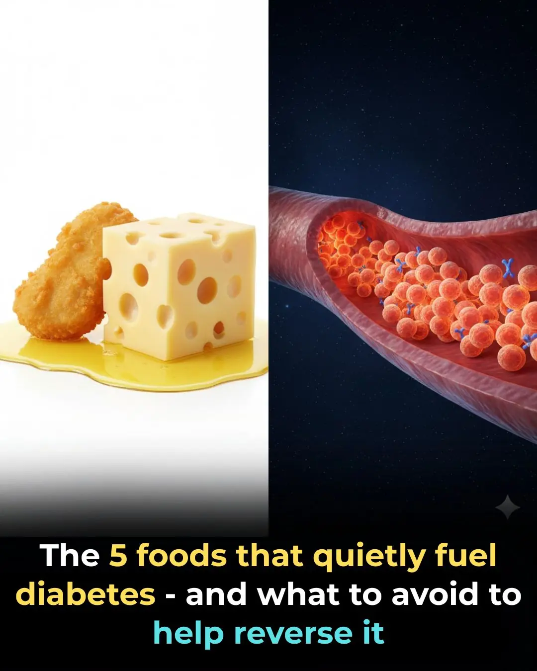 The 5 foods that quietly fuel diabetes — and what to avoid to help reverse it