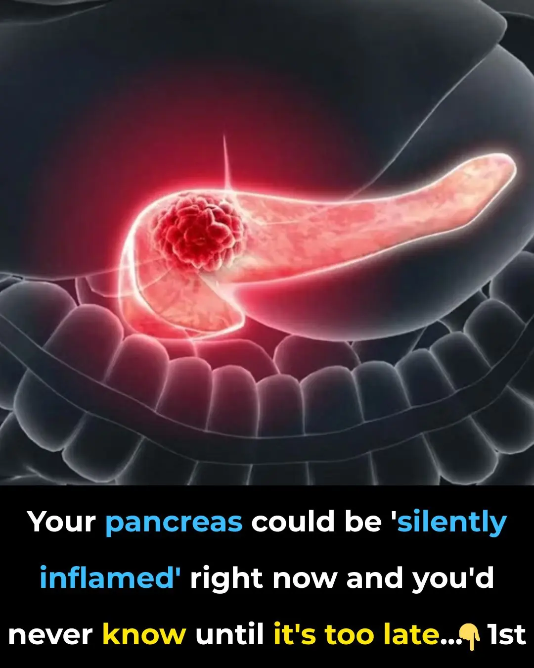 Your pancreas could be ‘silently inflamed’ right now and you’d never know until it’s too late