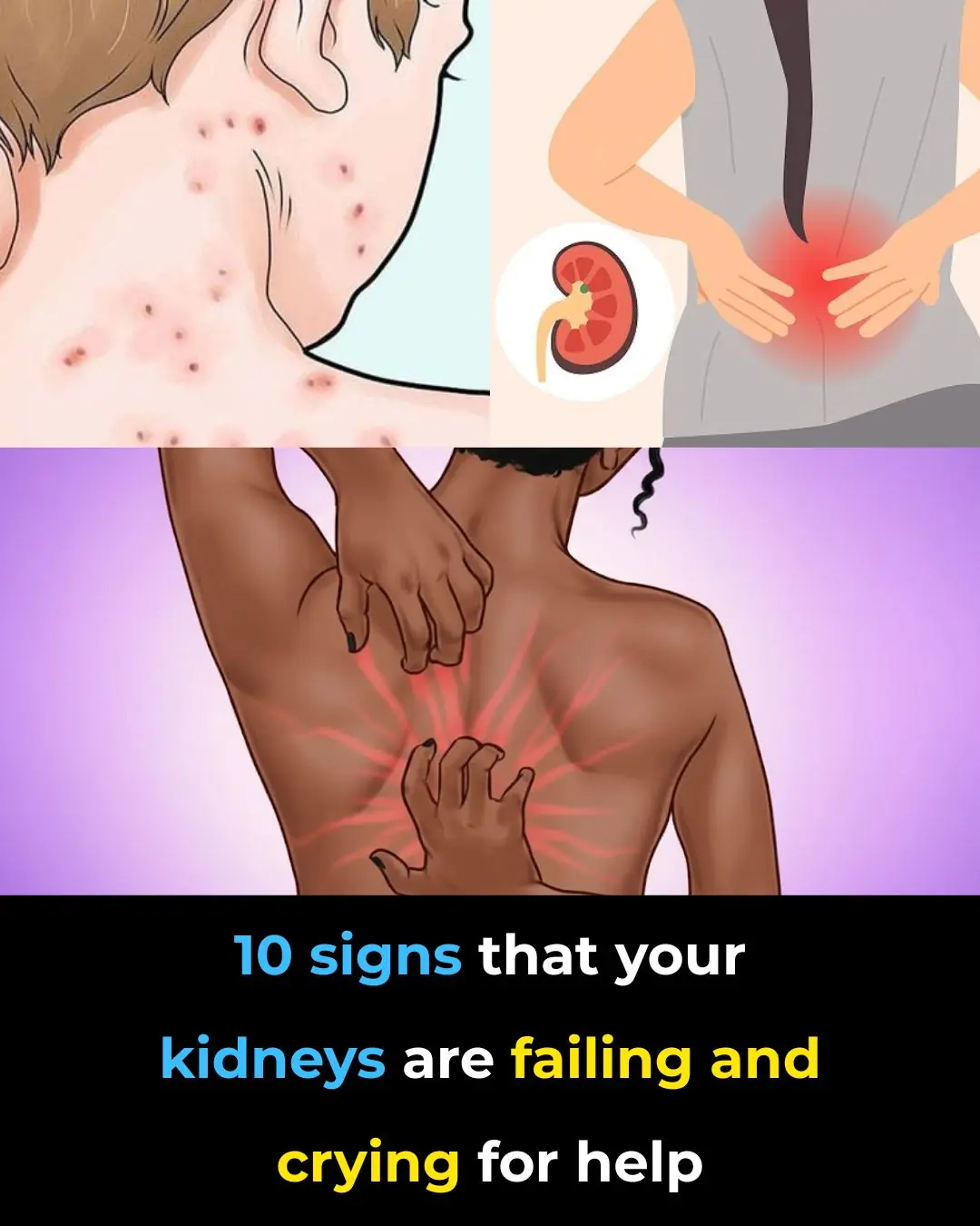 10 Warning Signs Your Kidneys May Be in Danger
