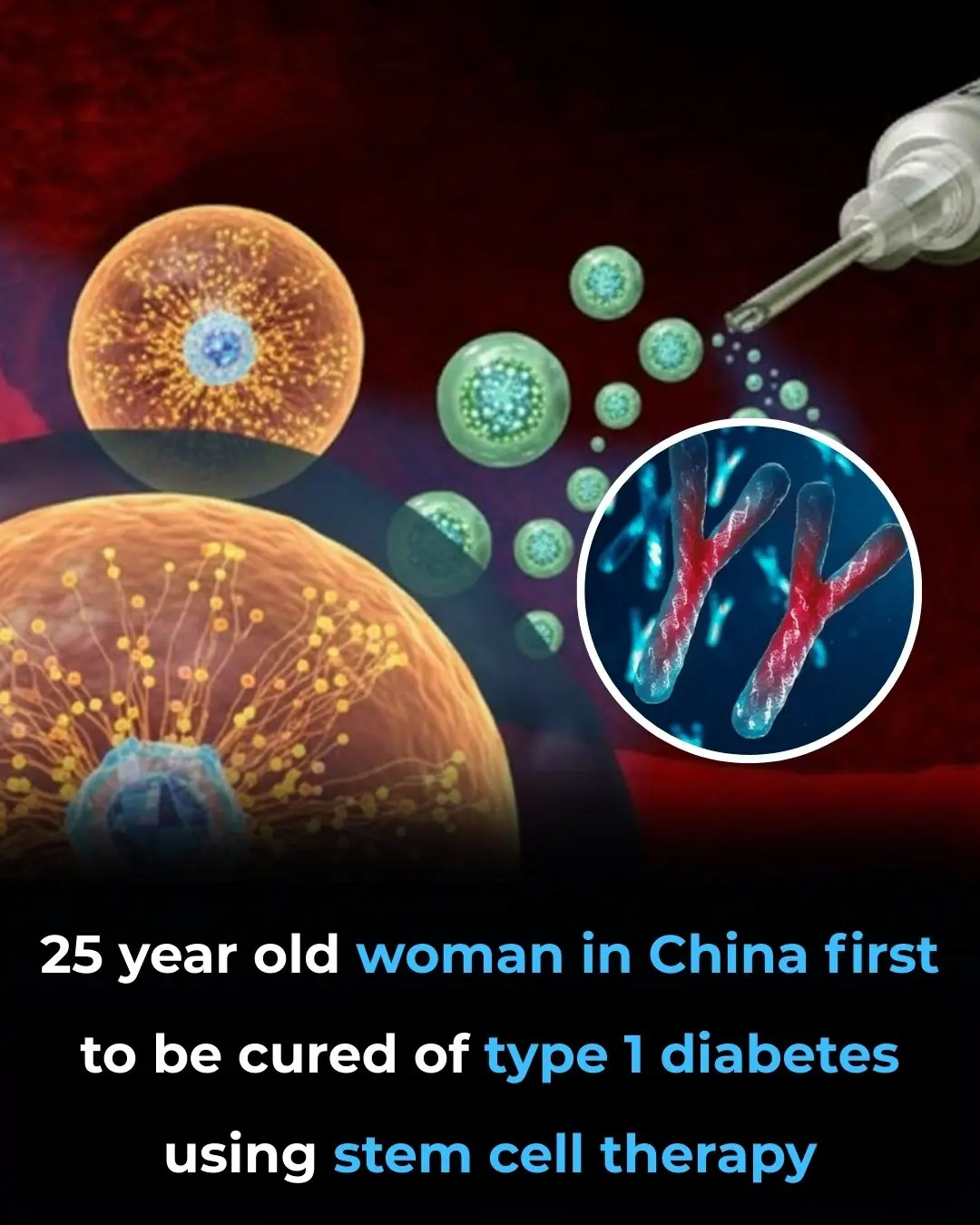 First Person Cured of Type 1 Diabetes Using Stem Cell Therapy: A Groundbreaking Medical Achievement