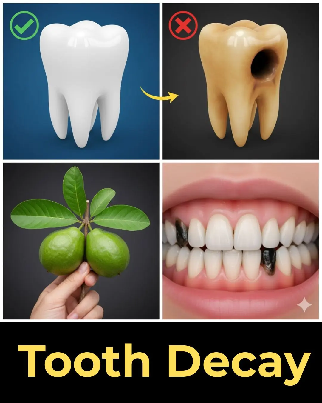 Tooth Decay Repair with Natural Remedies: Can Guava Leaves Help?