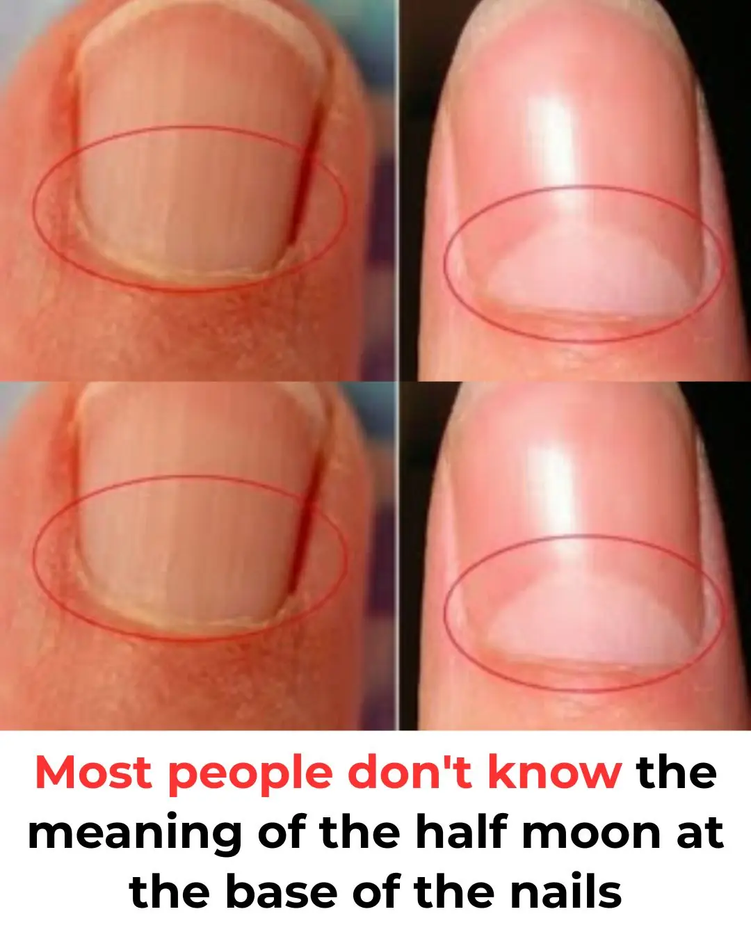 What Does The Half Moon at The Base of The Nails Mean