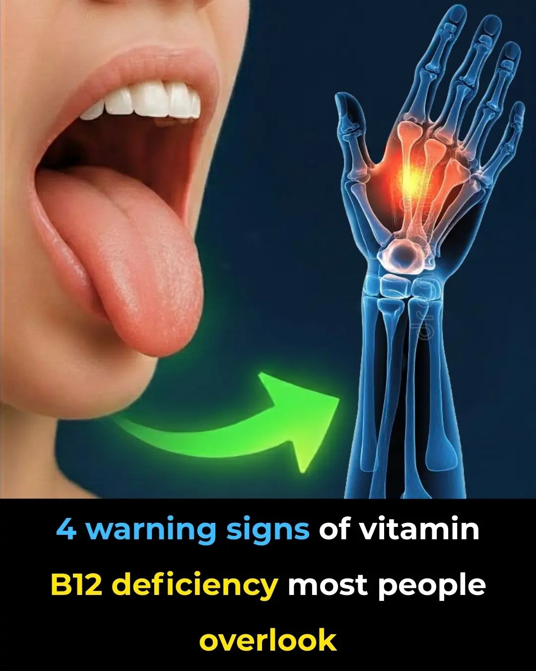 4 alarming symptoms of vitamin B12 deficiency you canāt ignore!