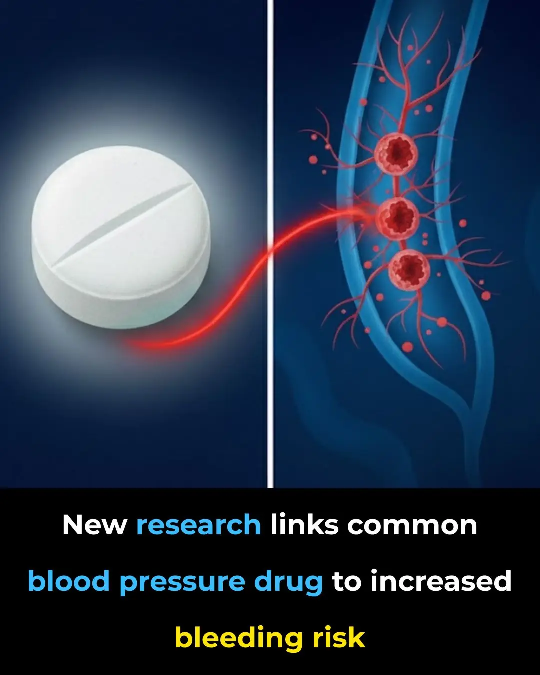 New research links common blood pressure drug to increased bleeding risk