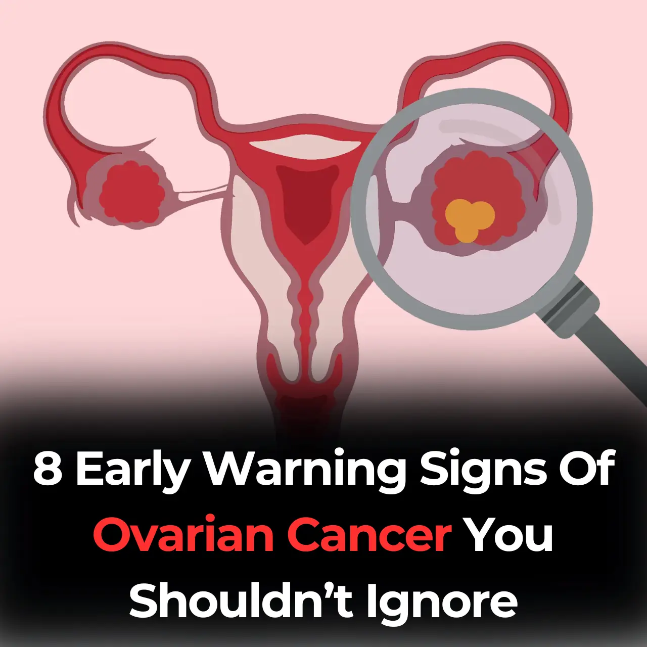 8 Early Warning Signs Of Ovarian Cancer You Shouldnāt Ignore