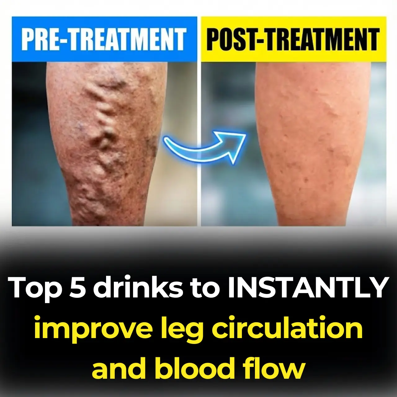 Top 5 drinks to INSTANTLY improve leg circulation and blood flow