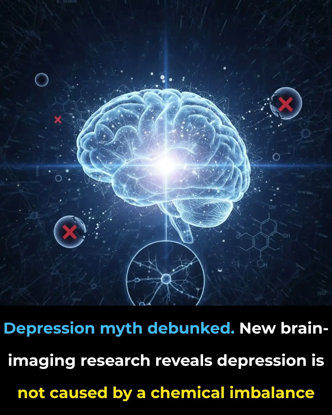 Rethinking Depression: New Brain-Imaging Research Reveals It’s More Than a Chemical Imbalance