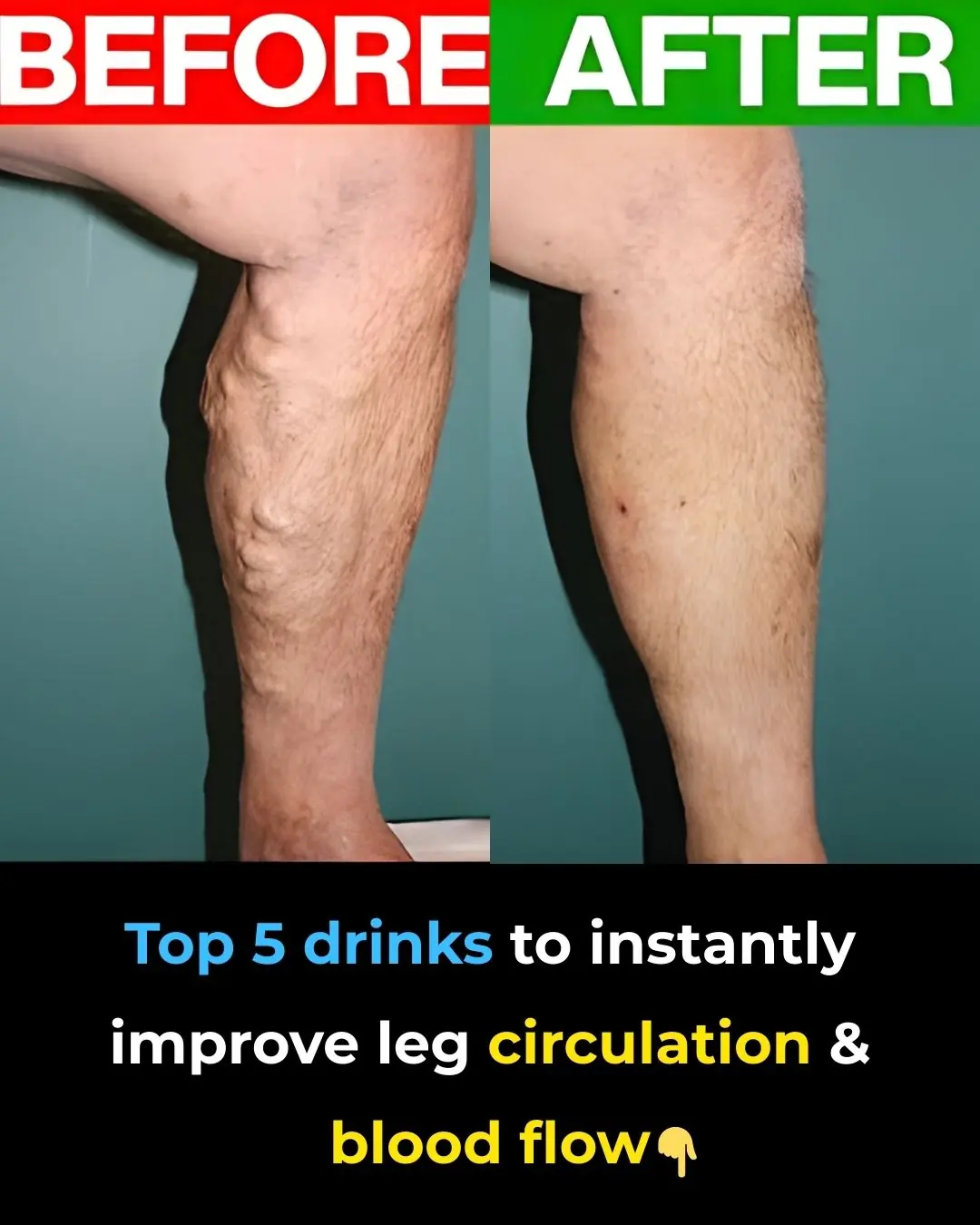 Top 5 drinks to INSTANTLY improve leg circulation and blood flow