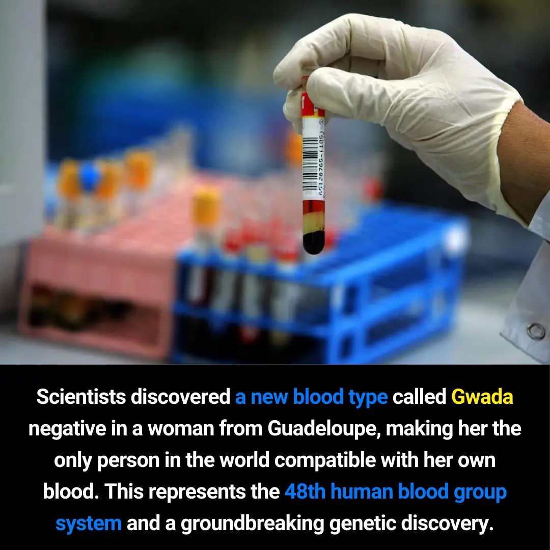 Gwada Negative: The 48th Human Blood Group and an Extraordinary Genetic Discovery