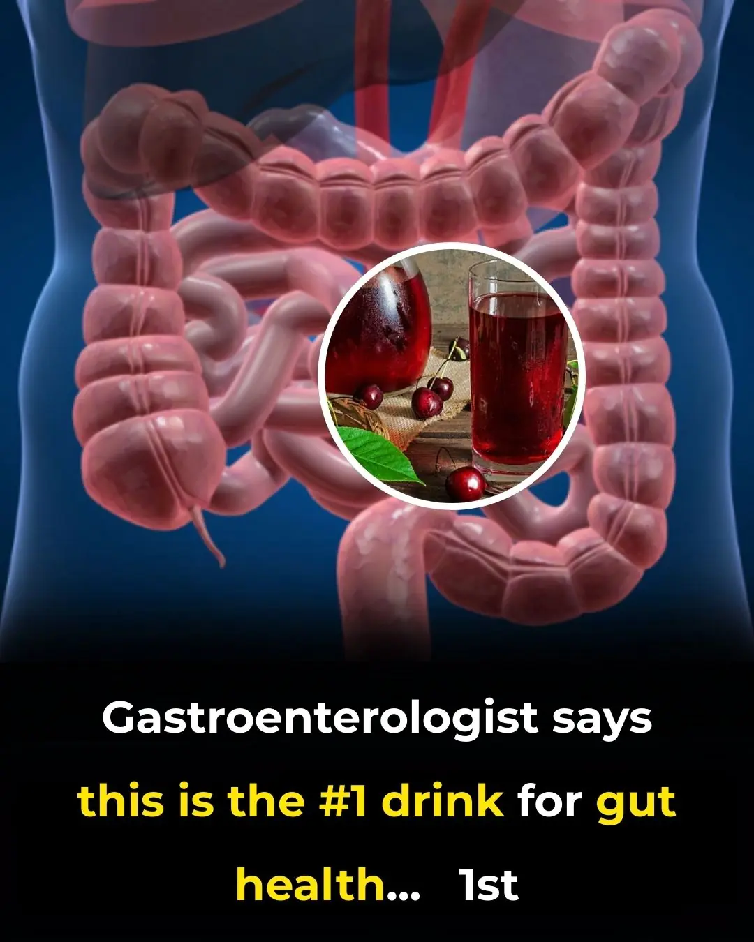 Gastroenterologist says this is the #1 drink for gut health