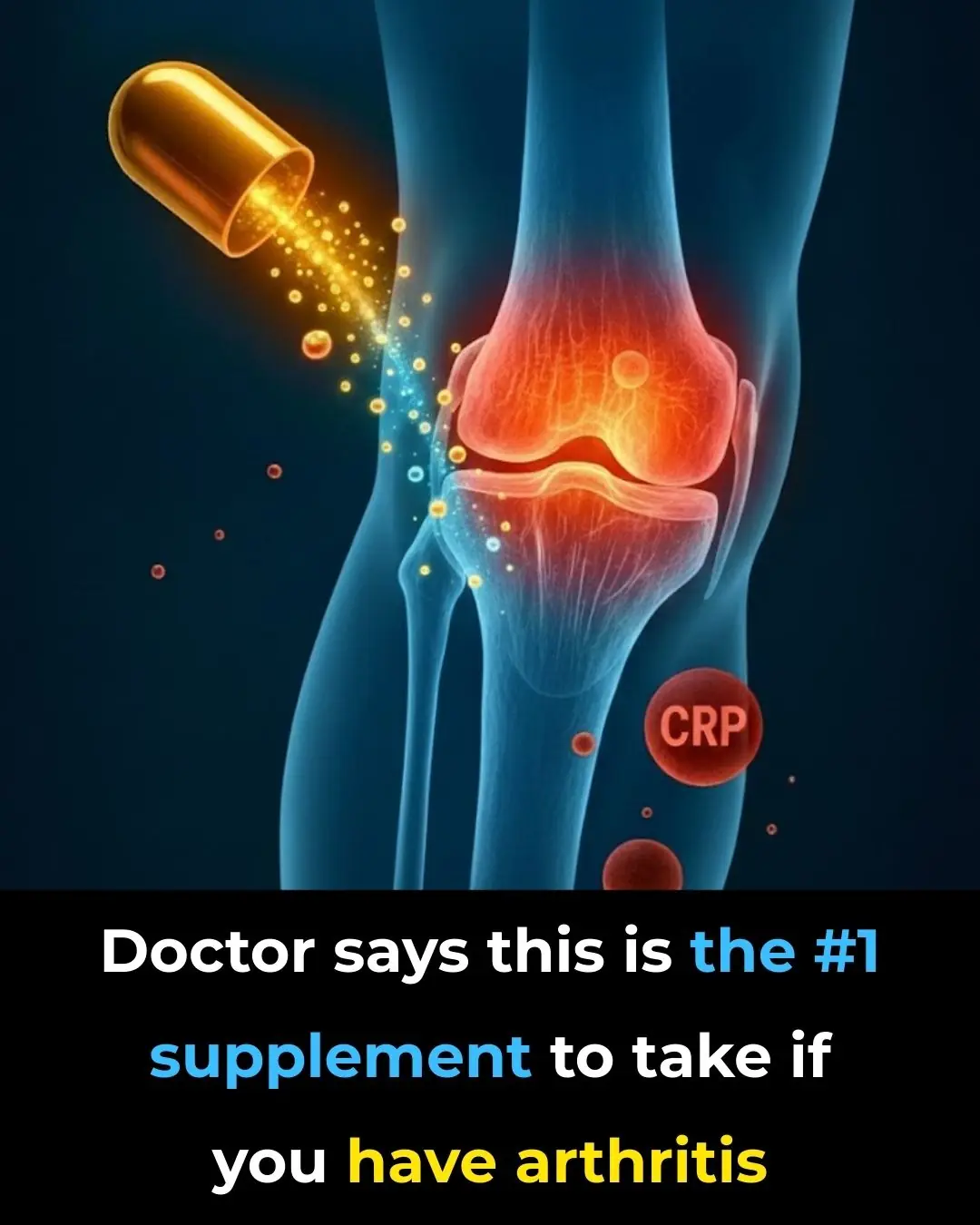 Doctor says this is the #1 supplement to take if you have arthritis