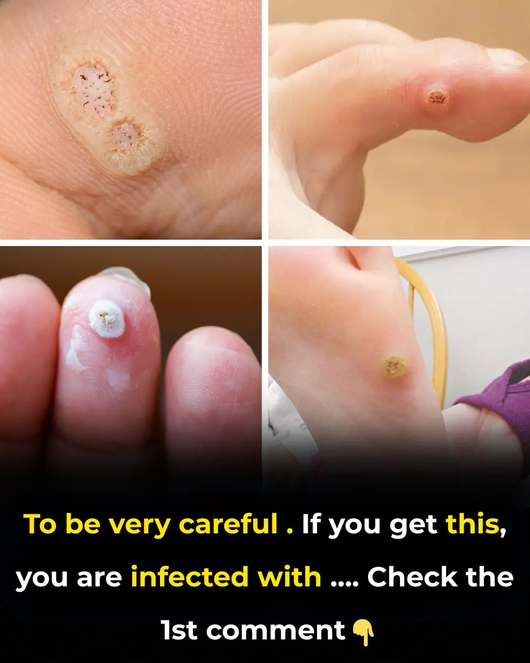 🩺 Be Aware: If You Notice This Skin Change, It Could Be Skin Cancer — Here’s What to Look For