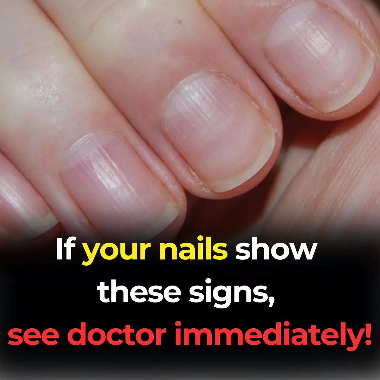 11 Health Warnings Your Fingernails May Be Sending