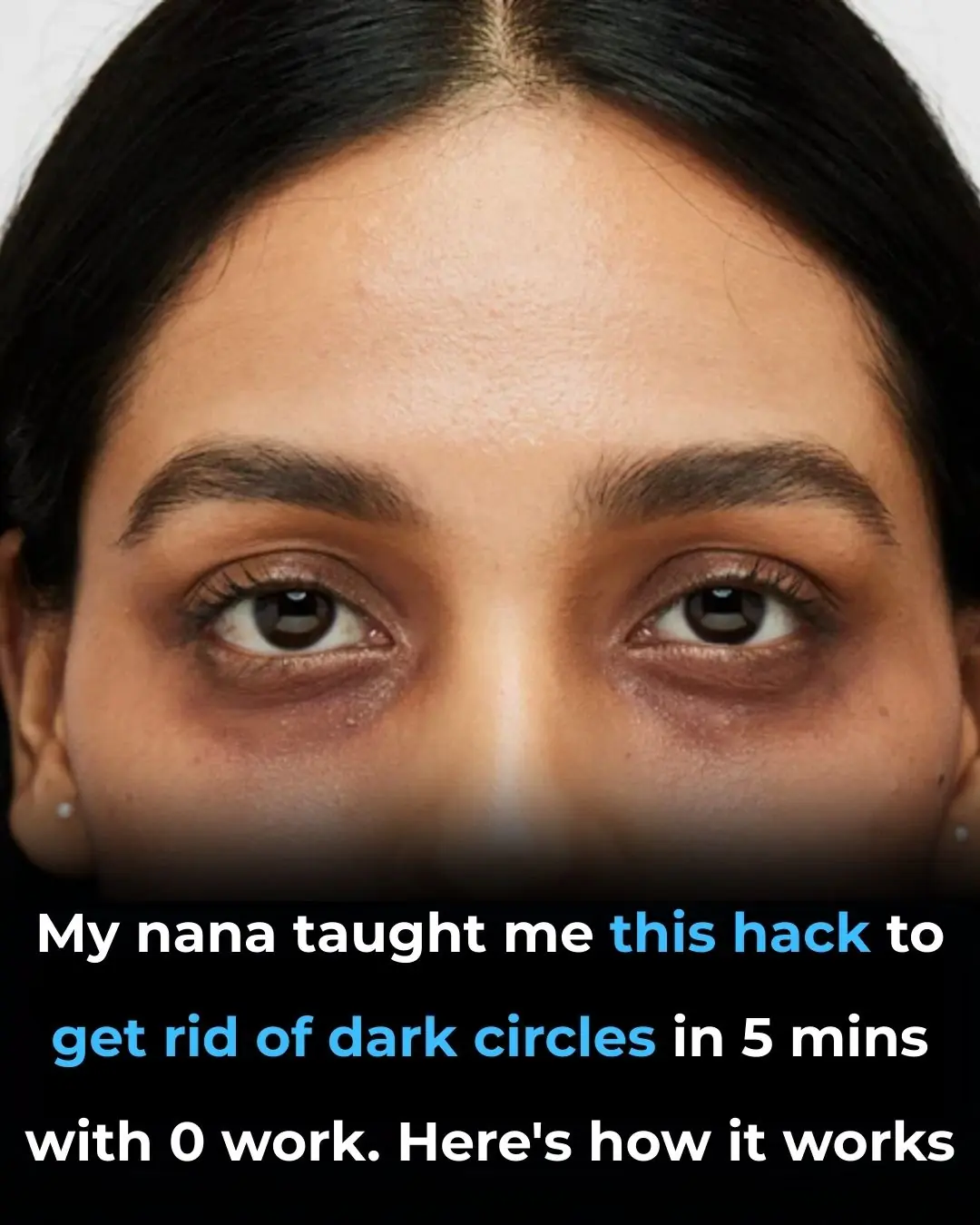 My nana taught me this hack to get rid of dark circles in 5 mins with 0 work. Here’s how it works