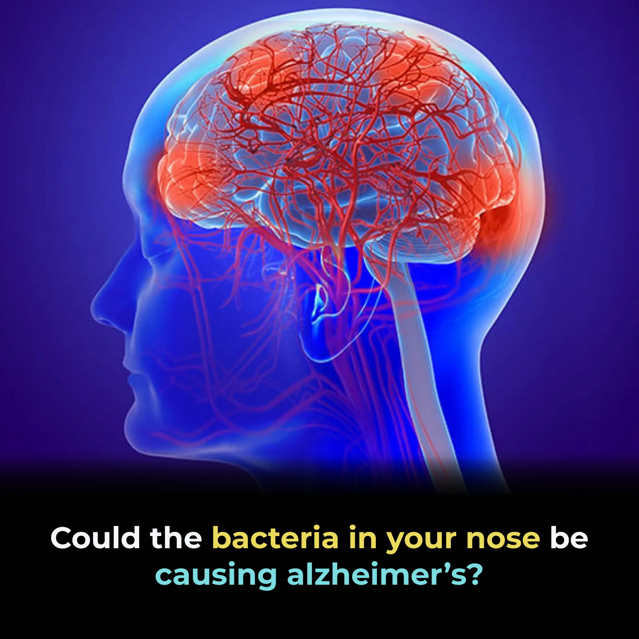 COULD THE BACTERIA IN YOUR NOSE BE CAUSING ALZHEIMER’S?