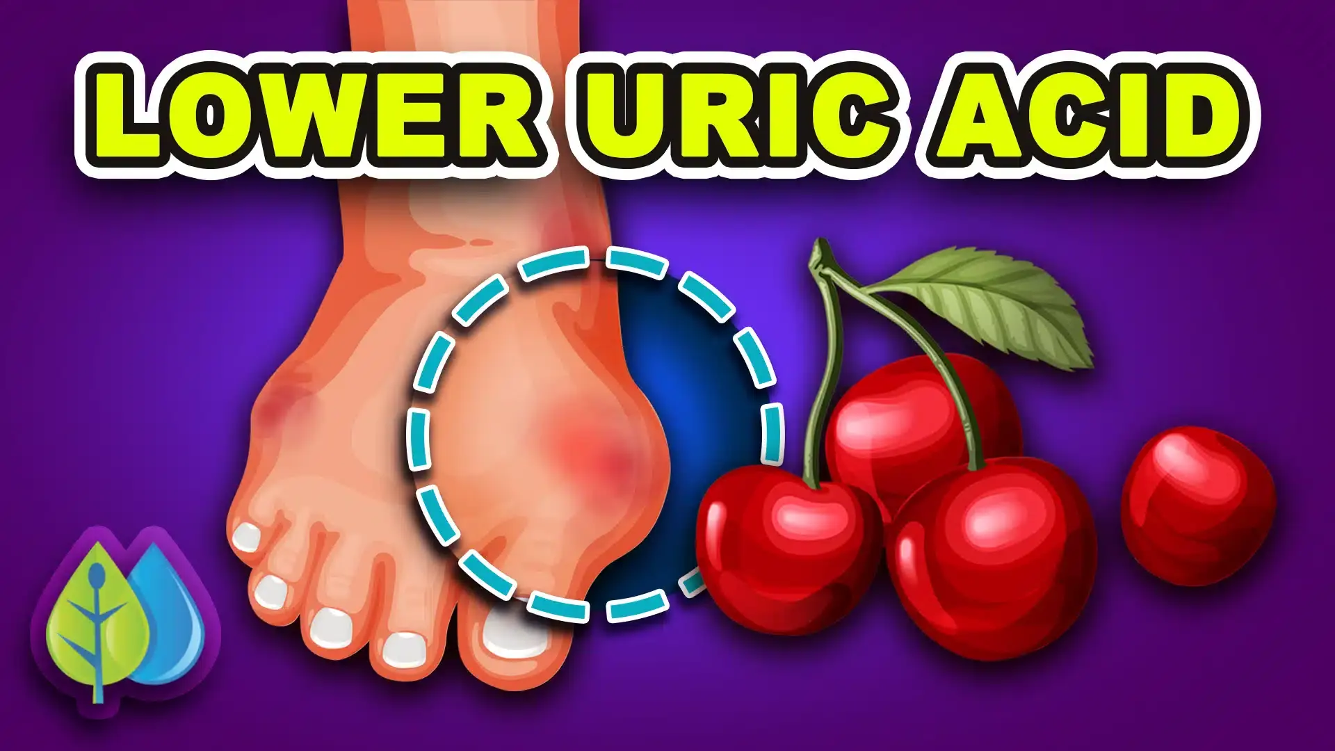 10 Ways to Lower Uric Acid Naturally