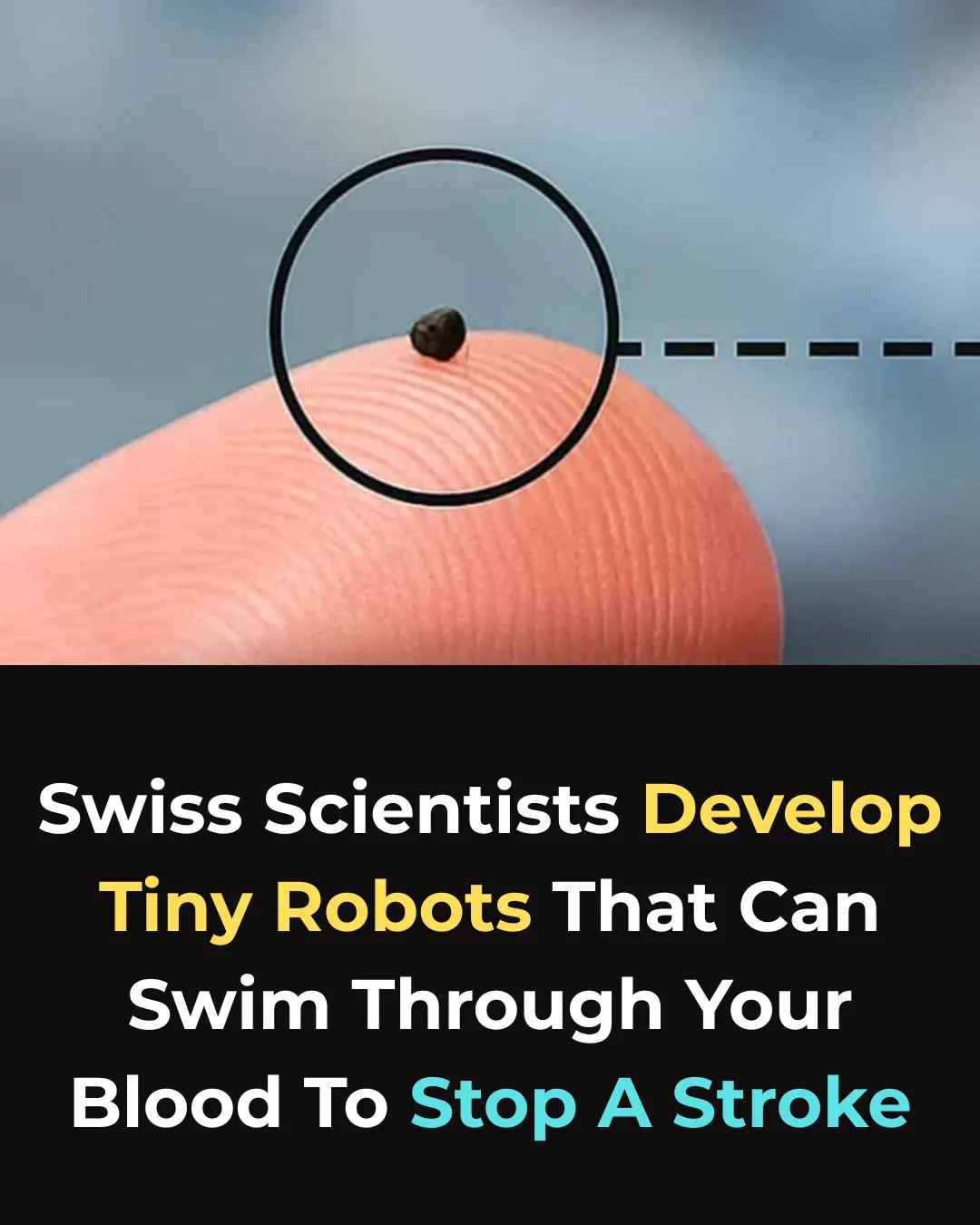 A New Breakthrough: Magnetic Microrobots Designed to Navigate Blood Vessels and Stop Strokes