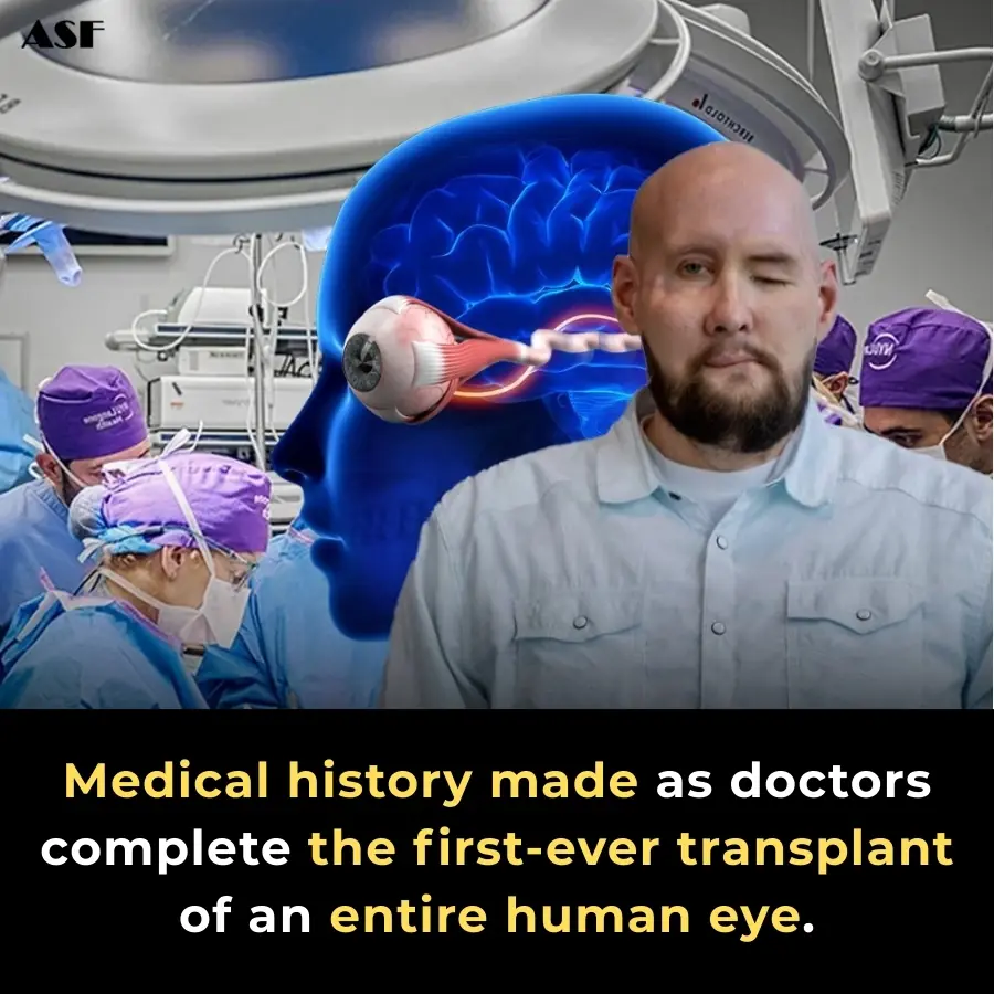 World’s First Full Human Eye Transplant Shows Promising Survival