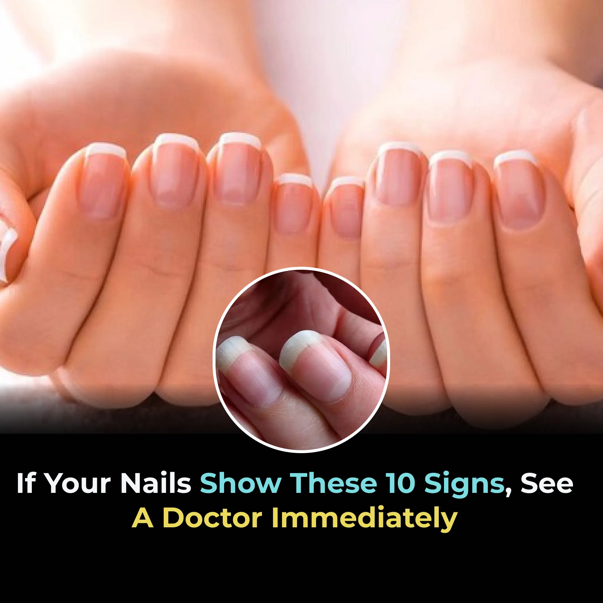 If Your Nails Show These 10 Signs, See a Doctor Immediately