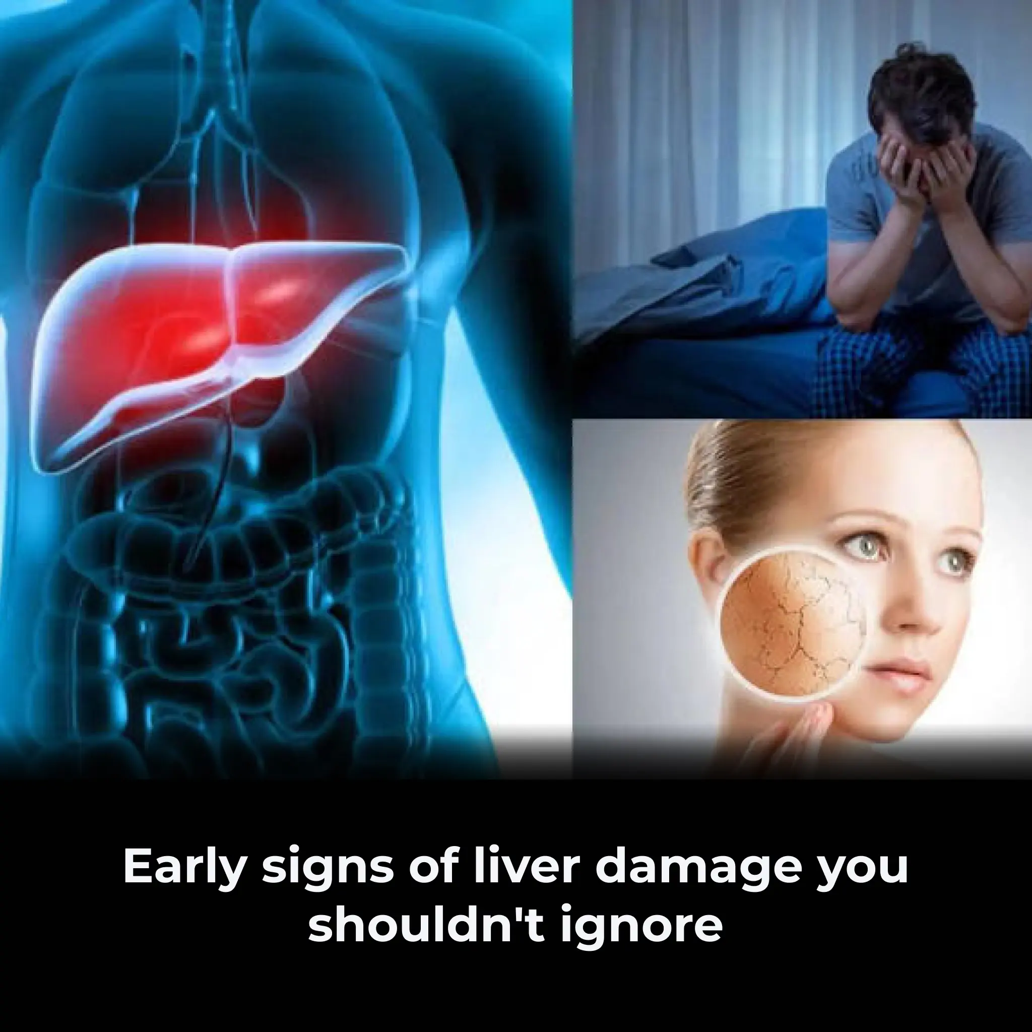 Early Signs of Liver Damage You Shouldn't Ignore