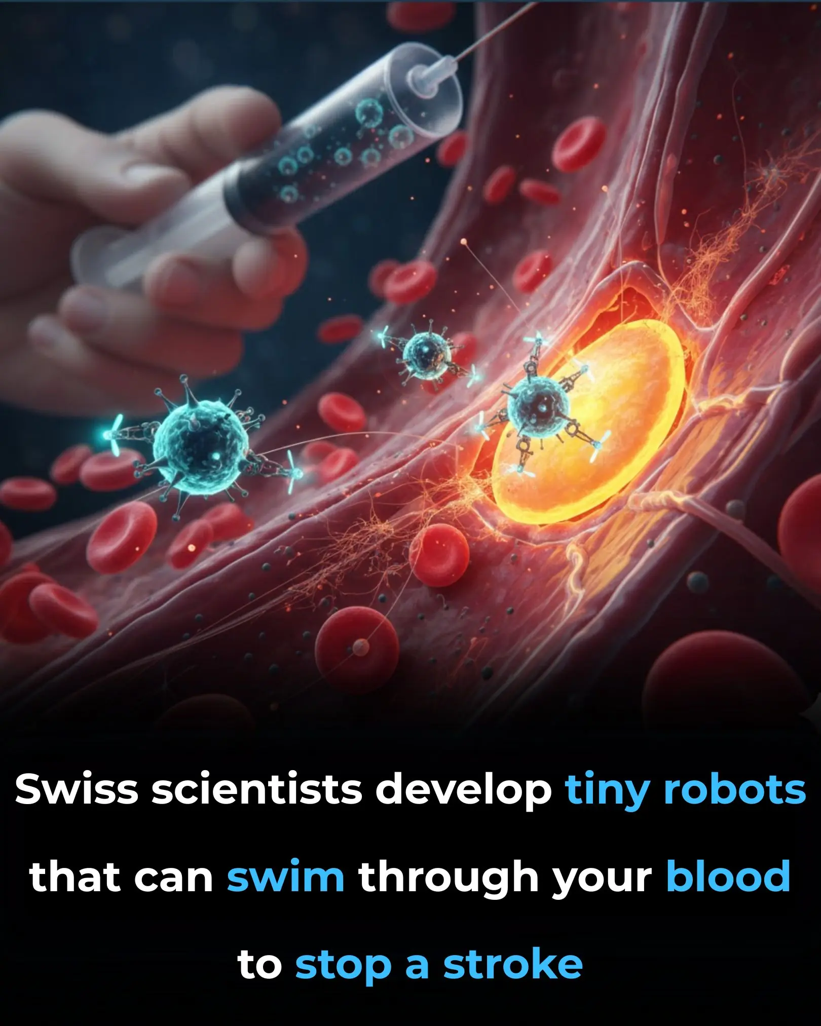 Revolutionary Magnetic Microrobots Could Transform Stroke Treatment with Targeted Therapy