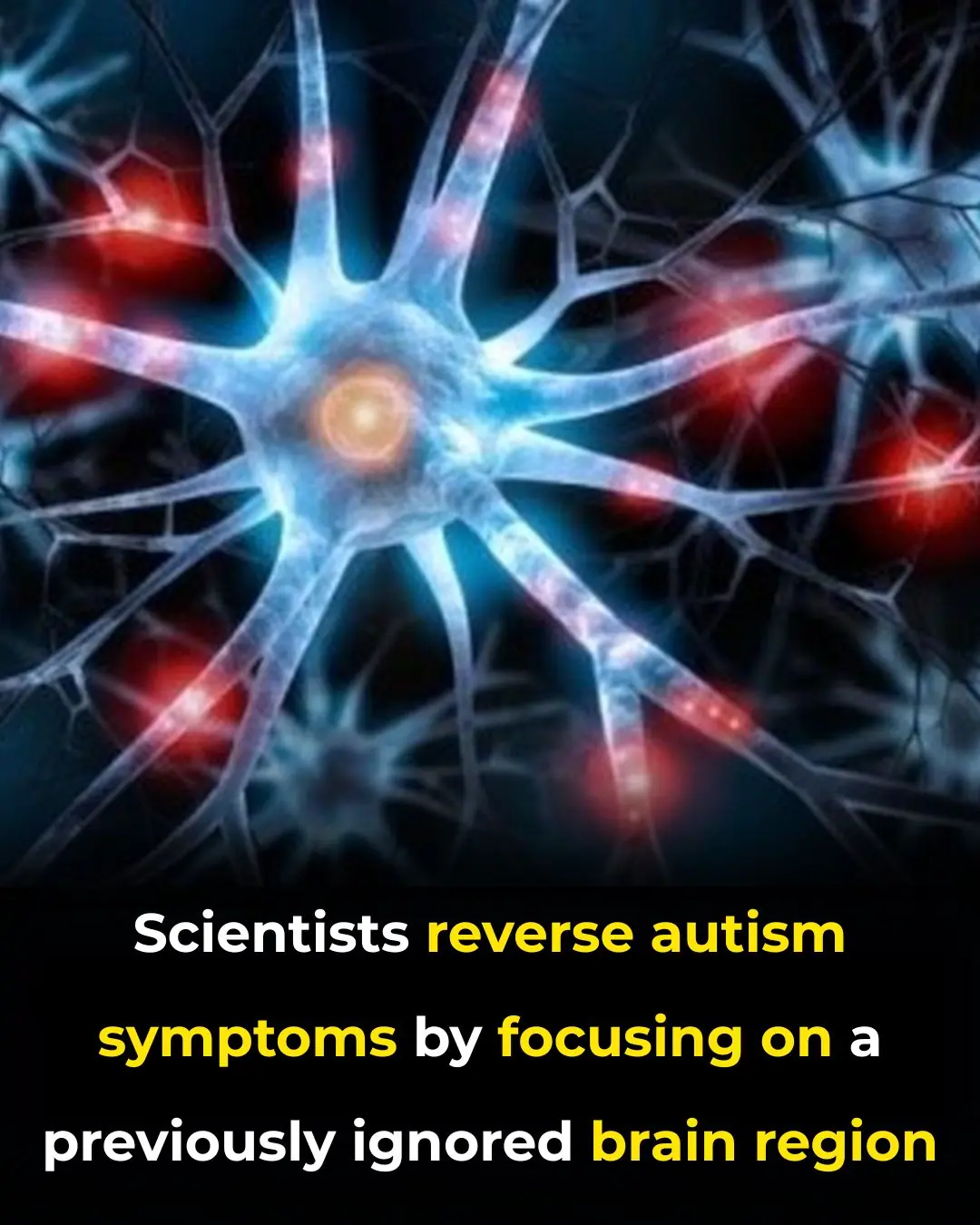 Targeting a Hidden Brainstem Circuit: New Breakthrough Reverses Core Autism Symptoms in Lab Models