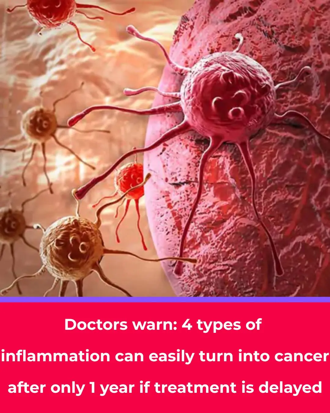 Doctors Warn: 4 Types of Inflammation That Can Turn Into Cancer Within a Year If Left Untreated