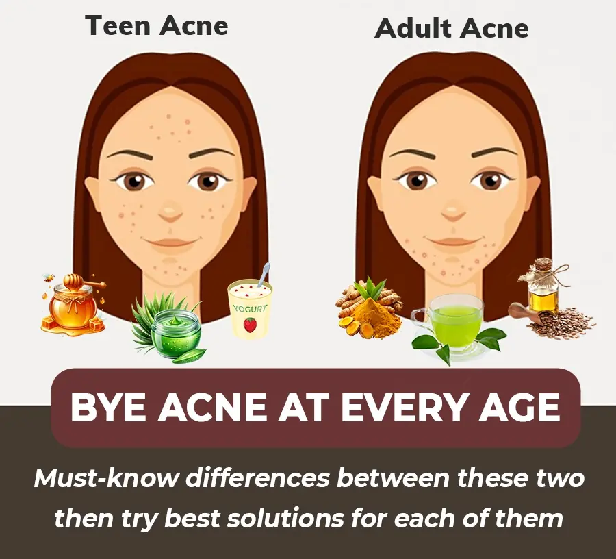 When Will I Outgrow My Acne? The Difference Between Adult and Teen Acne