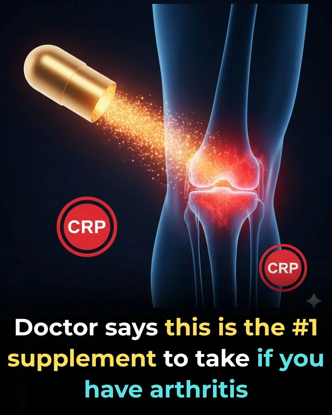 Doctor says this is the #1 supplement to take if you have arthritis