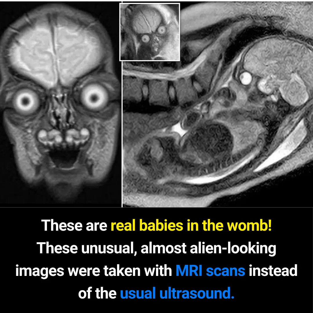 🧠✨ Stunning MRI Images Reveal the Hidden World of Babies in the Womb