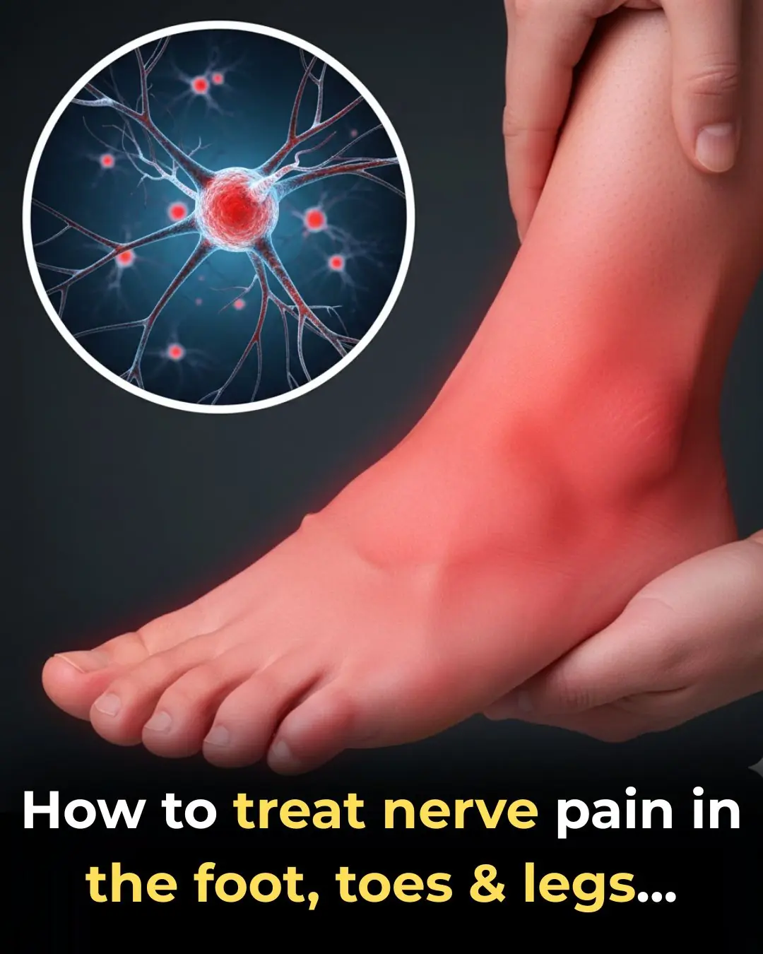 How to treat nerve pain in the foot, toes & legs