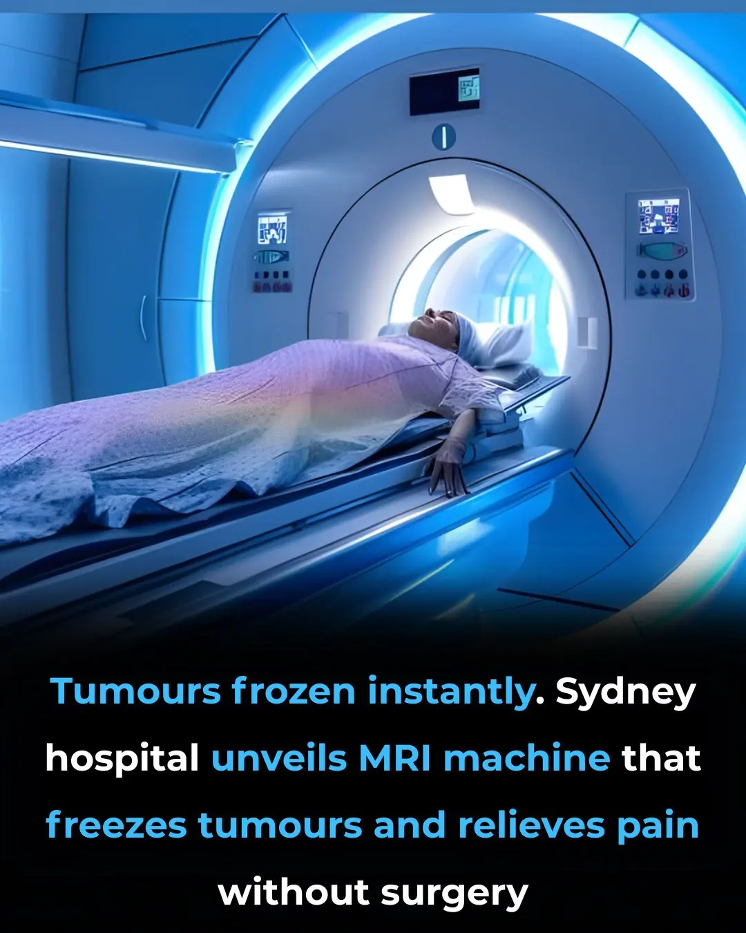 Revolutionary MRI Technology Offers Non-Invasive Tumour Treatment in Sydney