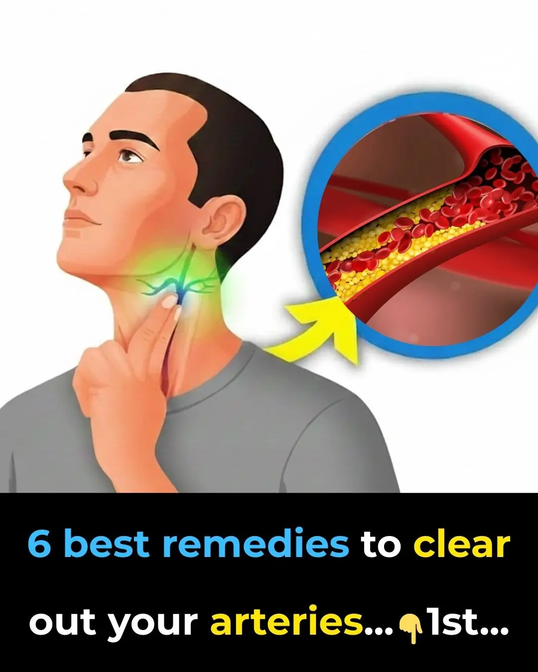 6 Best Remedies To Clear Out Your Arteries
