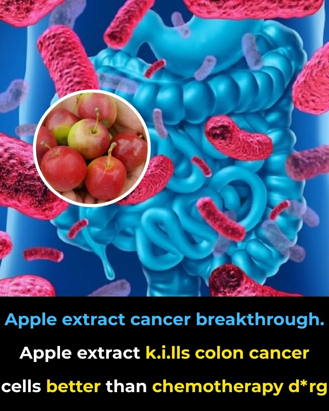Apple Extract: A Natural Alternative to Chemotherapy for Treating Colon Cancer